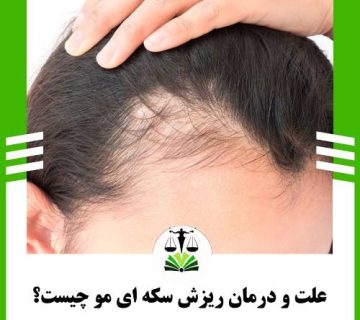 علت و درمان ریزش سکه ای مو چیست؟